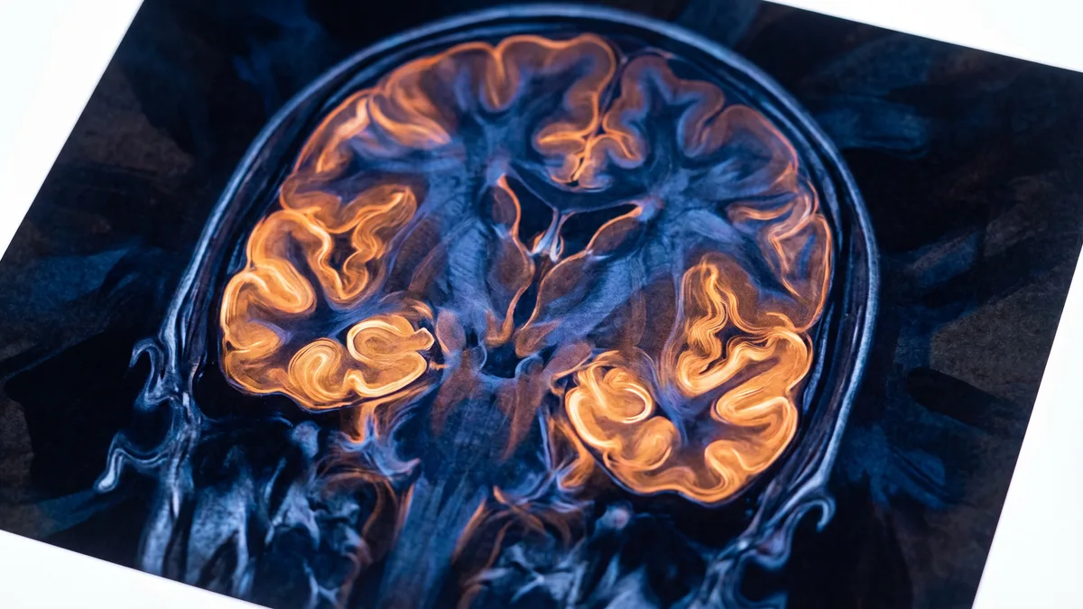 Polyvagal Theory and the Tinnitus Stress Response